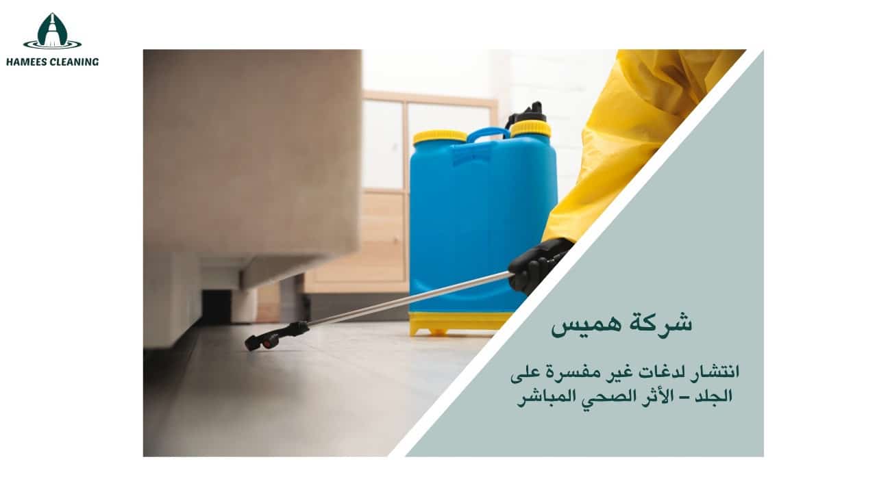 علامات وجود حشرات في المنزل
